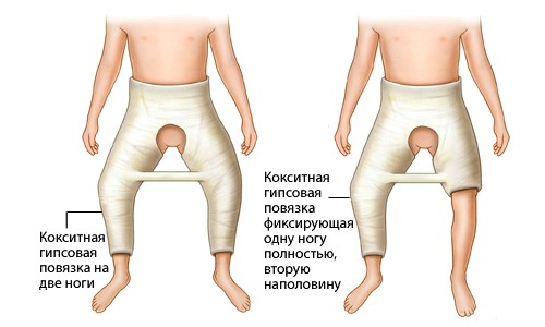 Лечение дисплазии скелета в Израиле