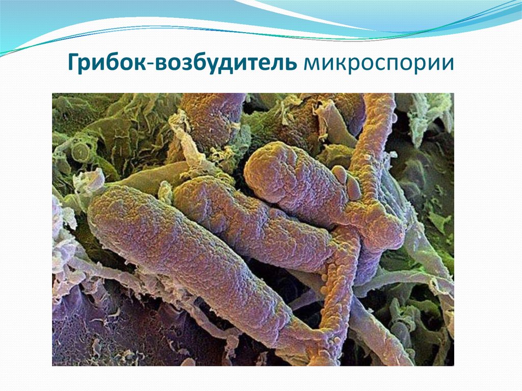 Возбудители микоза.jpg