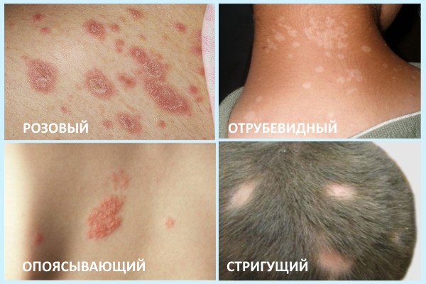 Виды лишая.jpg