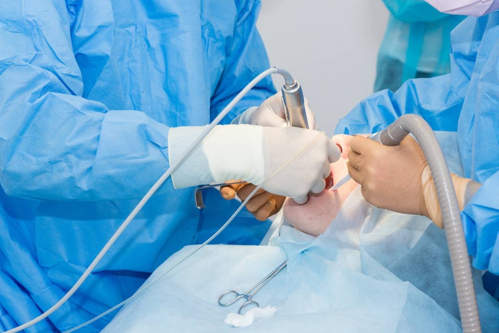 Как проводятся хирургические стоматологические операции в Израиле?