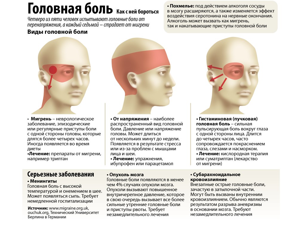 Головные боли2.jpg