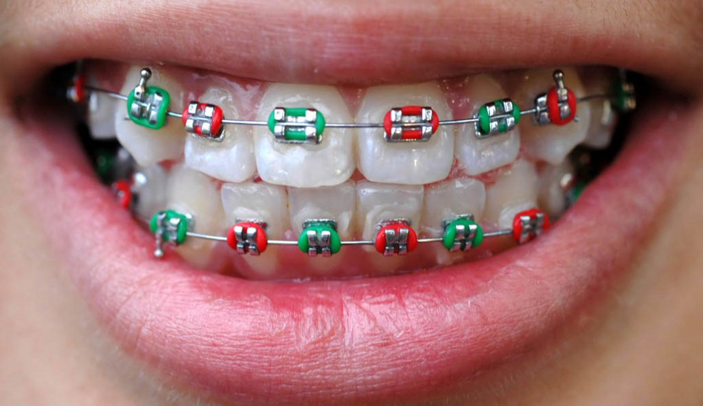 Преимущества израильской стоматологии: