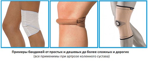 Виды вспомогательных суппортов при заболевании коленного сустава