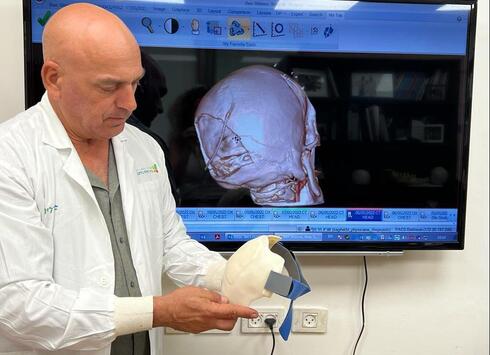 Израильские врачи восстановили голову с помощью напечатанного шлема